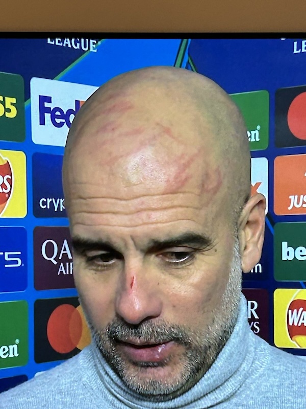 Il Telegraph fa a pezzi Guardiola che si graffia la faccia e dice: «Volevo farmi del male» – VIDEO